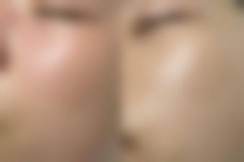 包头吴姝华美整形医院核心项目