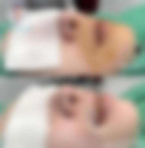 深圳美诚医疗美容门诊部价格参考