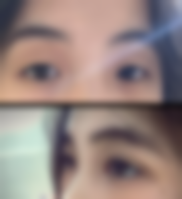 韩国MOTIVE整形外科医院价格参考