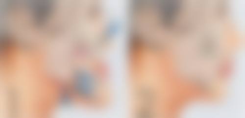 宫胜利患者评价