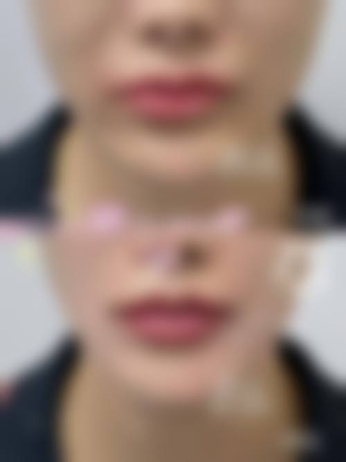 芜湖弋矶山医院整形美容中 心患者评价