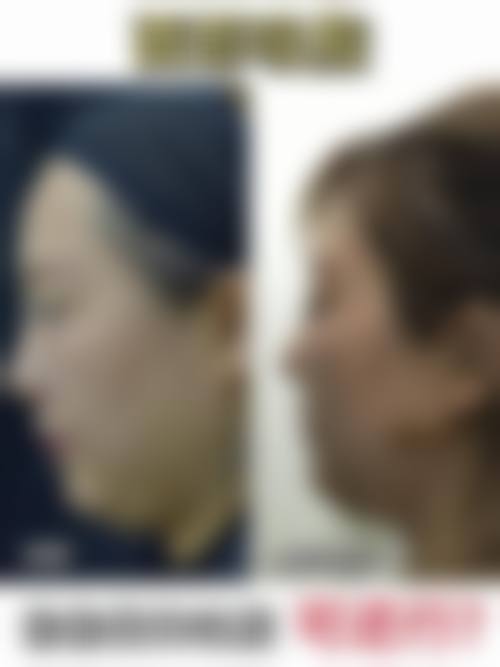 三亚天涯朱继锋医疗美容诊所核心项目