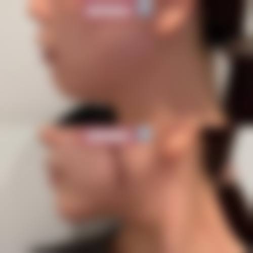 三亚天涯朱继锋医疗美容诊所价格参考