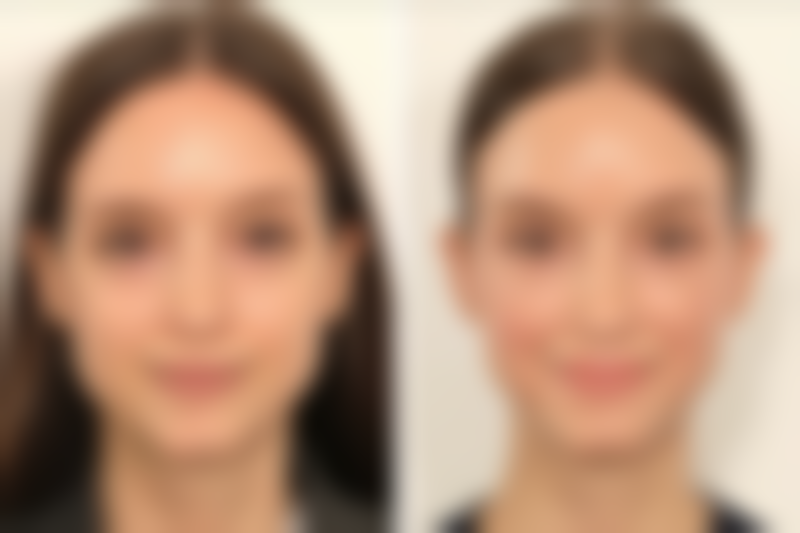 青岛赵宏武医疗美容机构交通路线与预约