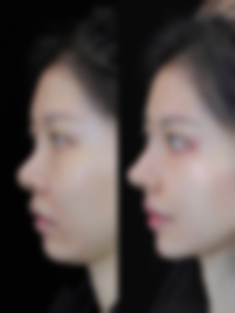 锦州博美雅医疗美容医院价格参考