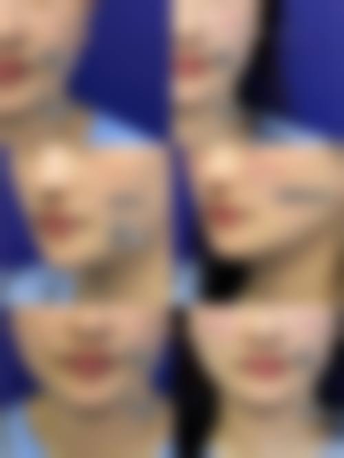 昆明卓星整形美容医院患者评价