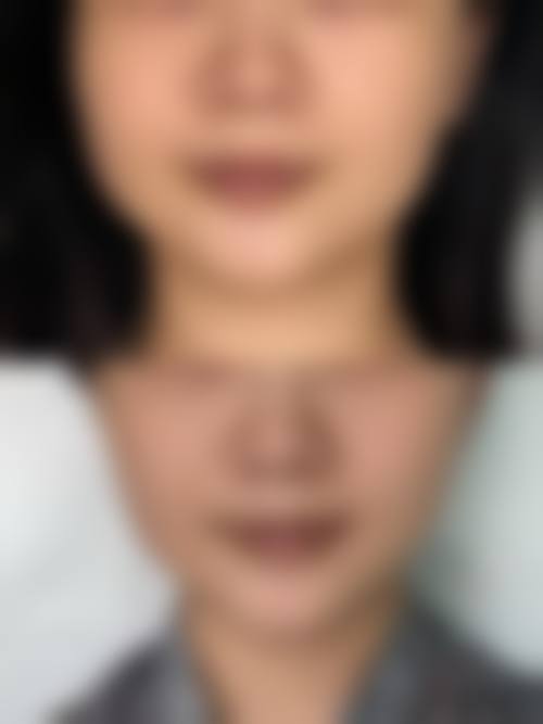 昆明卓星整形美容医院核心项目