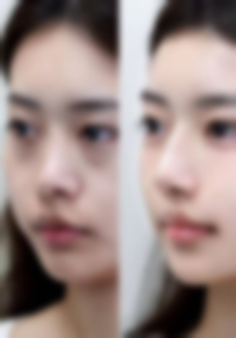 乌鲁木齐伊丽医疗整形美容门诊部正规资质