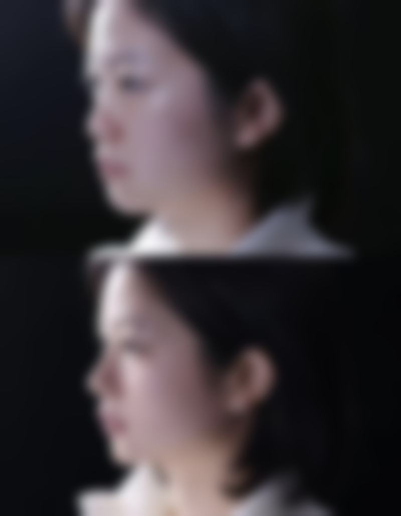 广州医咖医疗美容门诊部患者反馈