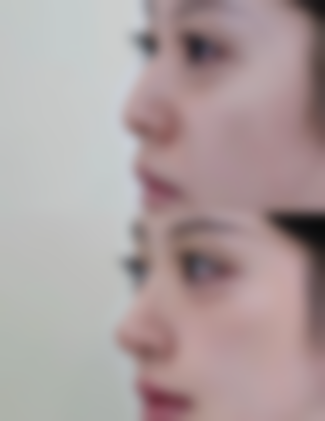 泰国康民医院整形外科中 心患者评价