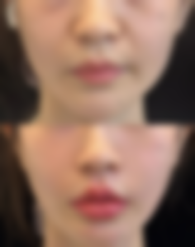 牟丹擅长项目列表