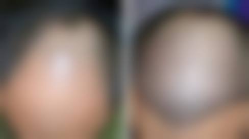 广州新生整形医疗美容门诊部价格参考