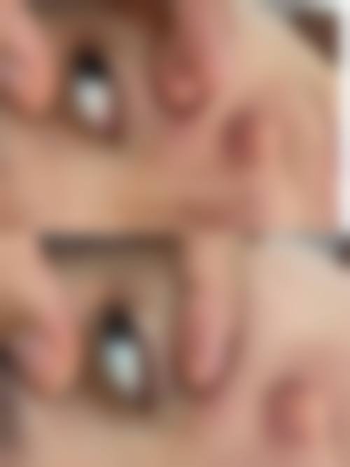 光山县人民医院(医学美容门诊)价格参考