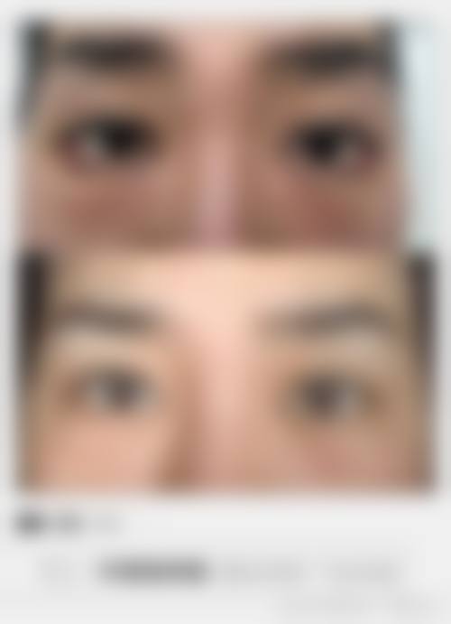 榆林熙美名媛荟整形医院价格参考