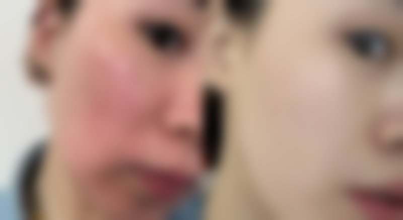 邛崃崃美医疗美容诊所价格参考