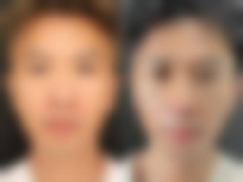 韩国Heart整形外科正规资质