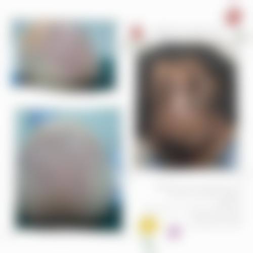 四川自贡铂美医疗美容患者评价