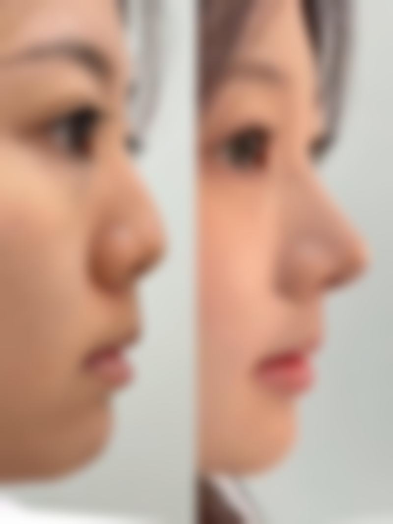 高卿豪擅长项目列表