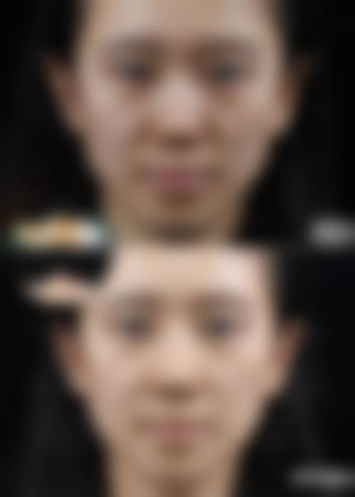 大连天俪医疗美容价格参考