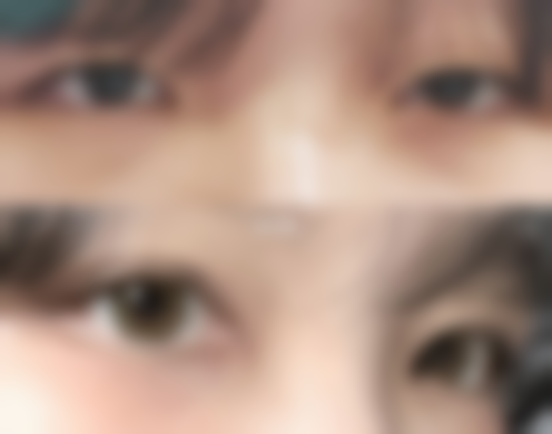 大连天俪医疗美容患者评价