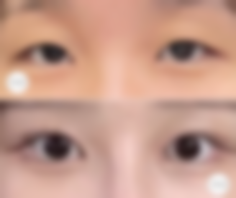 锡林浩特伊莲美人整形医院患者评价