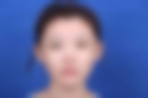 丽优美皮肤科蚕室店核心项目