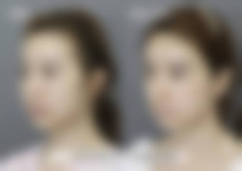 丽优美皮肤科蚕室店价格参考