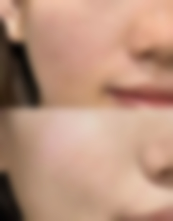 日照莫沁整形医院服务理念与患者反馈