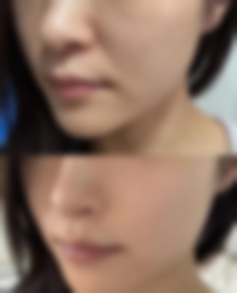 新乡史迪医疗美容价格参考