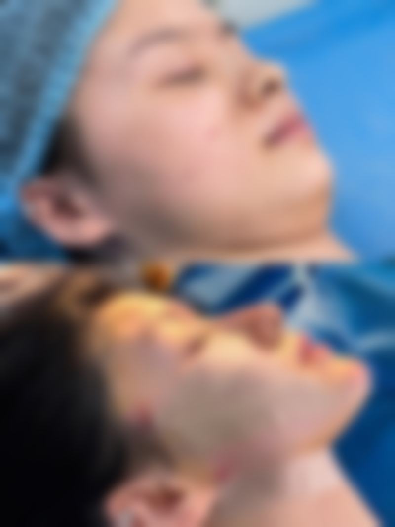 河南黄学峰整形美容中 心患者评价