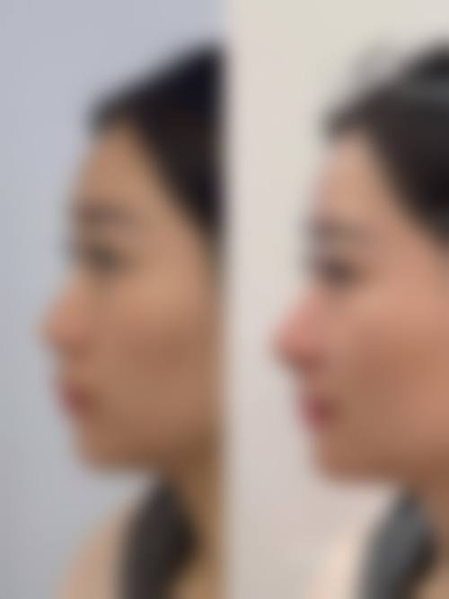 厦门华美整形医院地址及到院路线