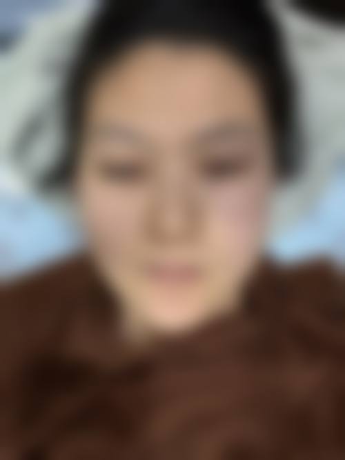 红河丽都医疗美容门诊部价格参考