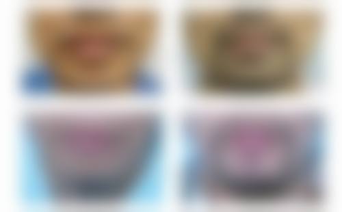 北京美之星整形美容诊所核心项目