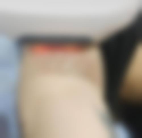 枣庄市玖美医疗美容患者评价