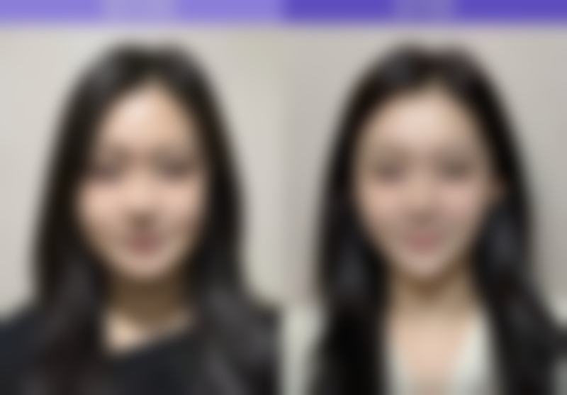 长沙黄迎玉医疗美容诊所患者评价