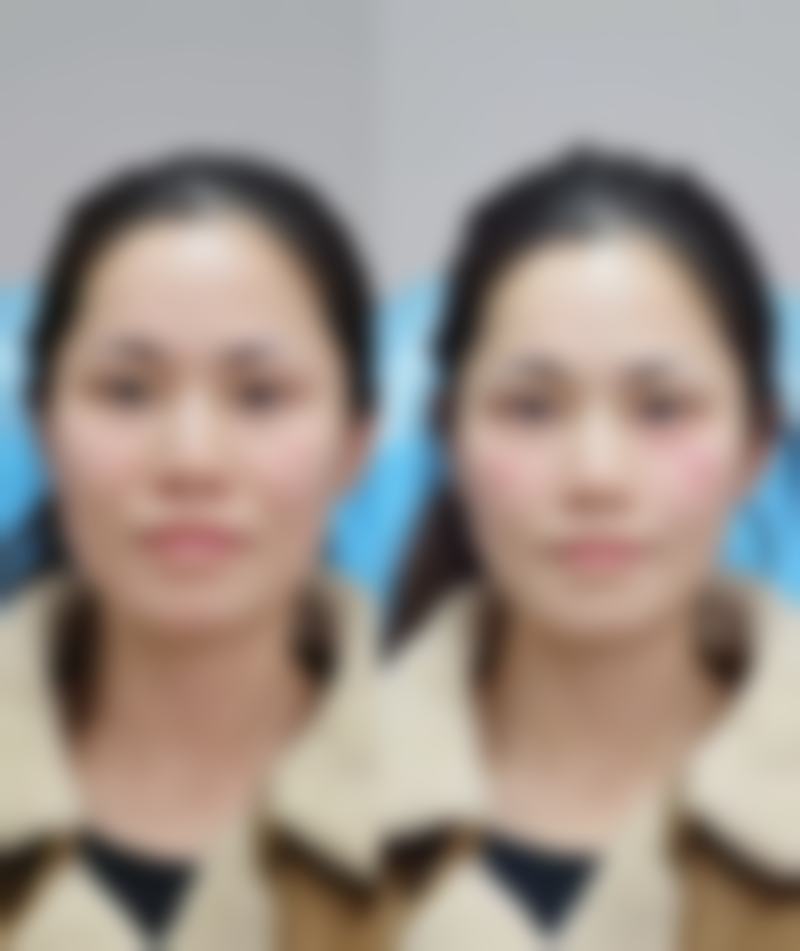 南宁科之美医疗美容患者评价