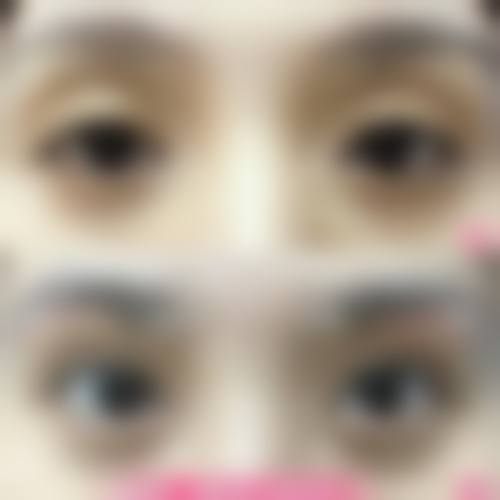 西安云湖整形医院患者评价