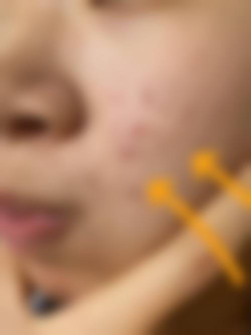 成都军康疤痕痤疮医学研究院交通路线与预约