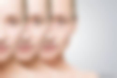 上海优颜艺医疗美容门诊部患者反馈