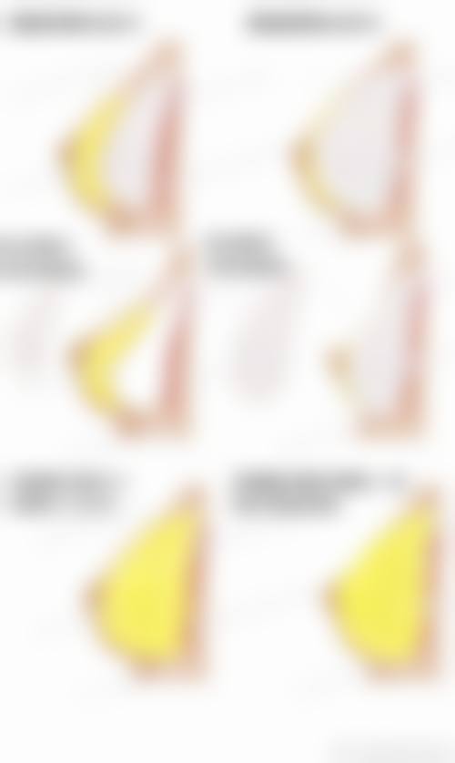 北京伊美尔爱康整形医疗美容医院核心项目