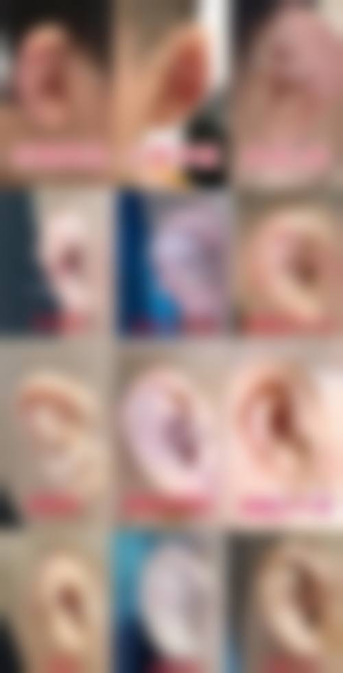 成都军康疤痕痤疮医学研究院患者评价