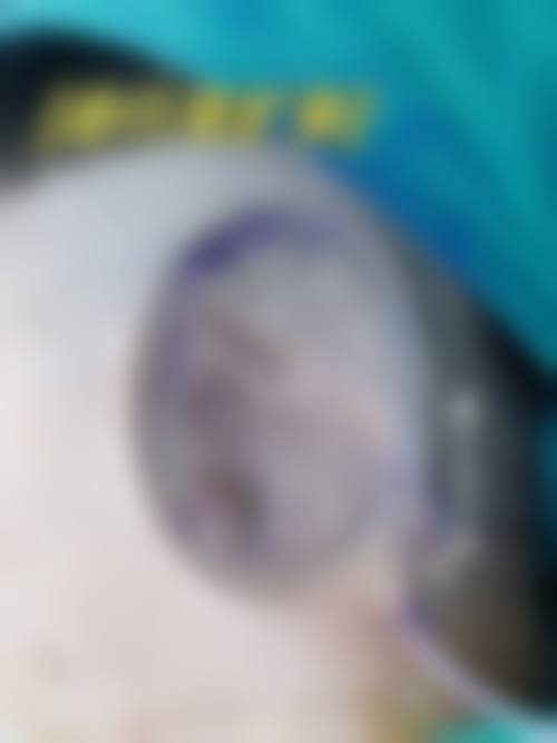 成都军康疤痕痤疮医学研究院医生团队