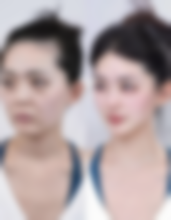 北京伊美尔爱康整形医疗美容医院价格参考