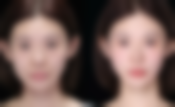 宜宾华伊佰颜整形医院价格参考