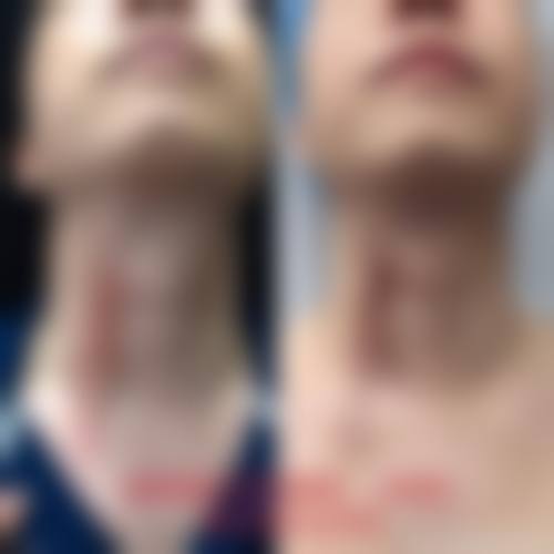 西安米莱医疗美容门诊部价格参考