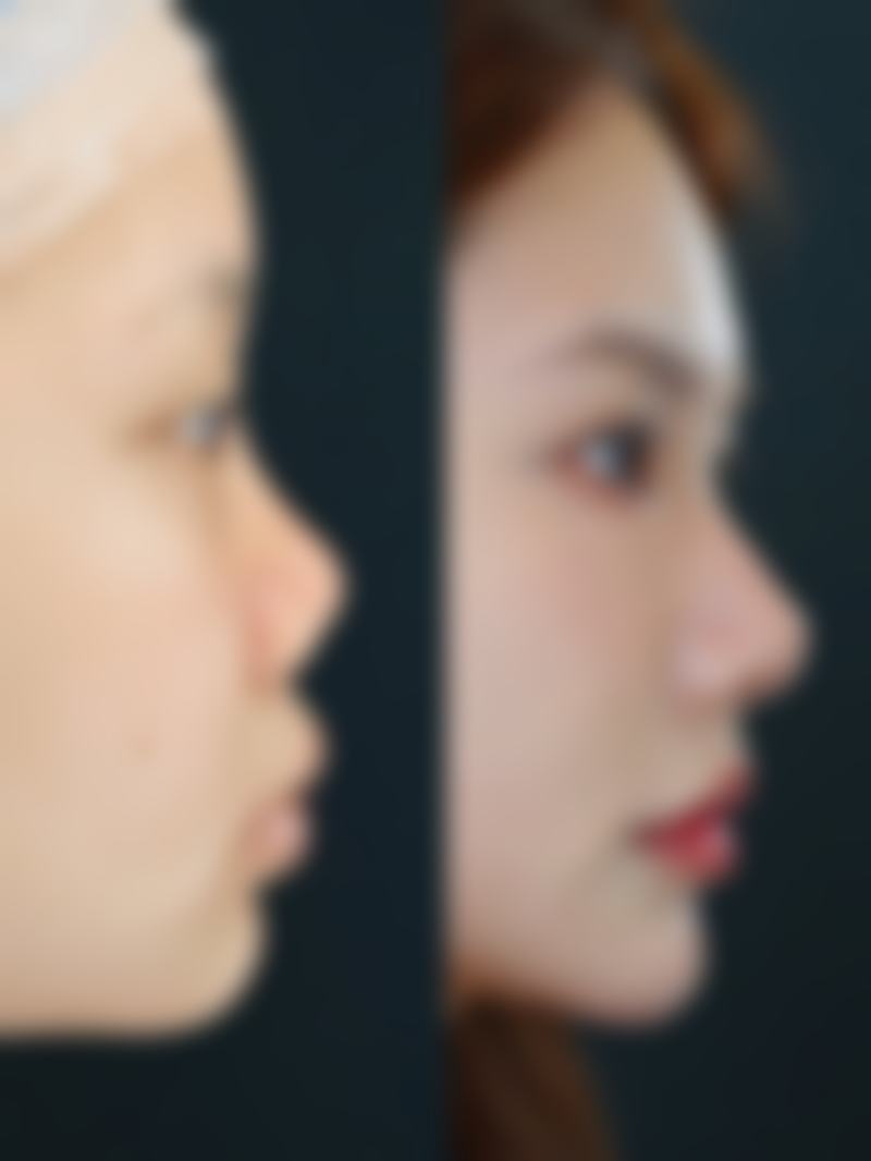 宋美擅长项目列表