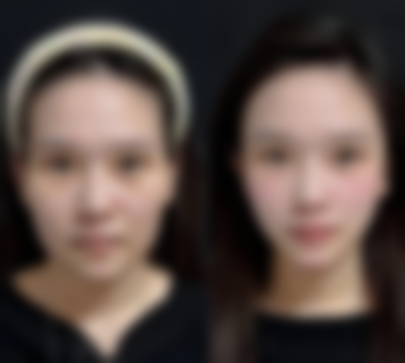 邱加恩患者评价