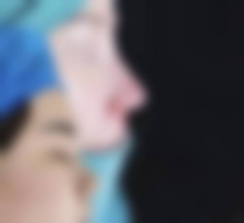 郑州星慧（星艺）医疗美容诊所核心项目