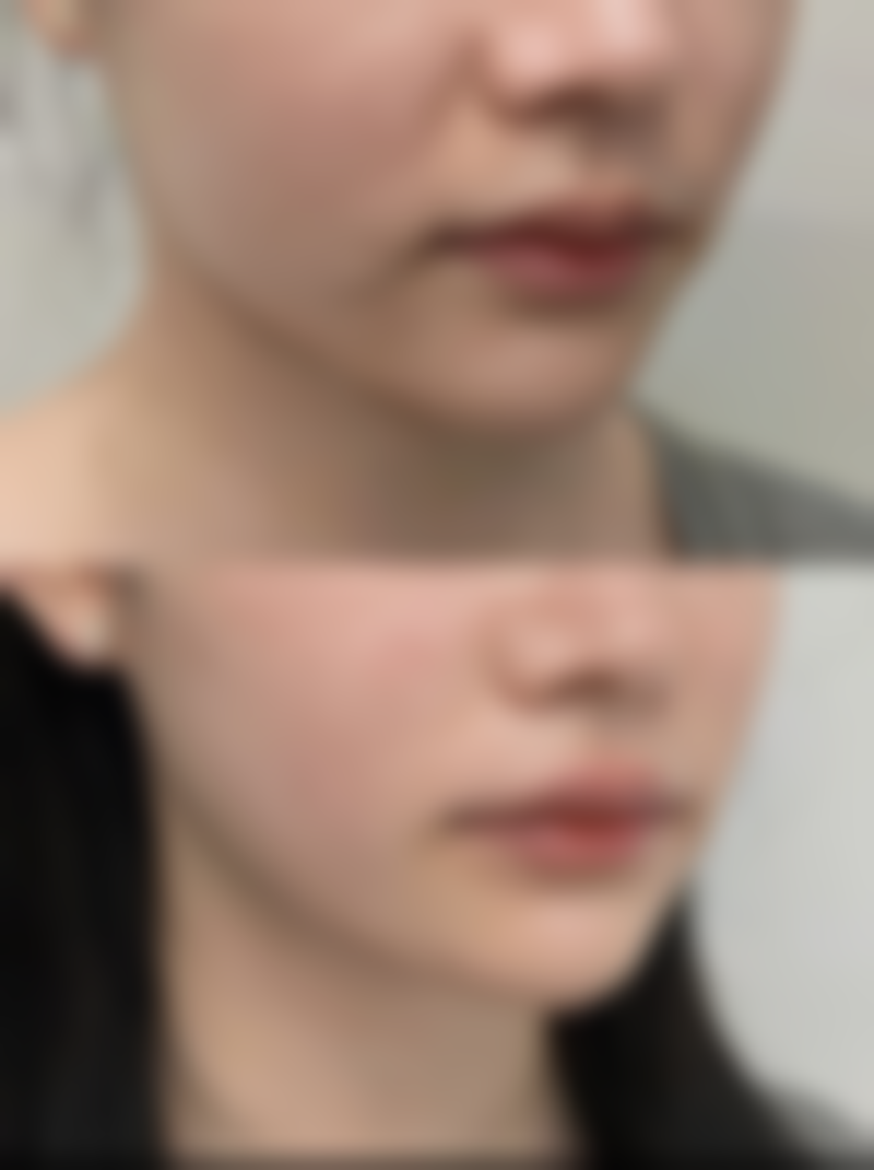 滕州美界医疗美容医院价格参考