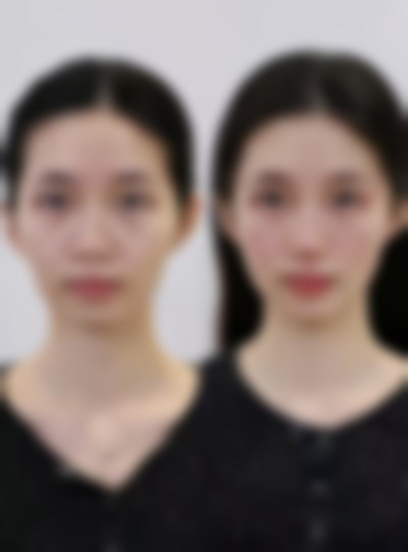 滕州美界医疗美容医院患者评价